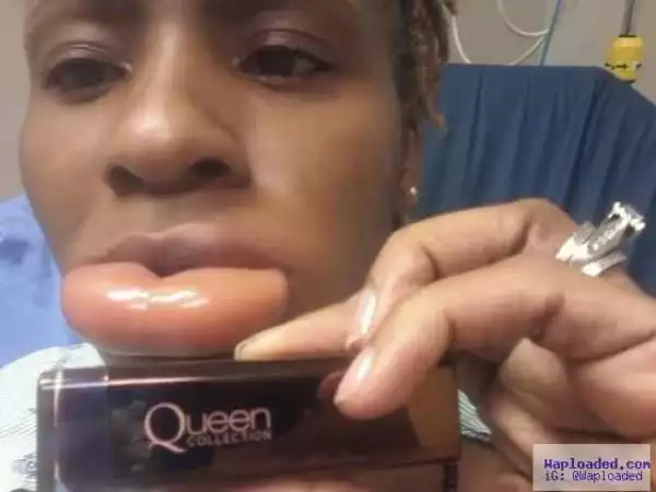 Woman claims lipstick left her with swollen lips (photos)
